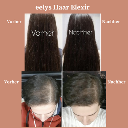 eelysHair Growth Elexir